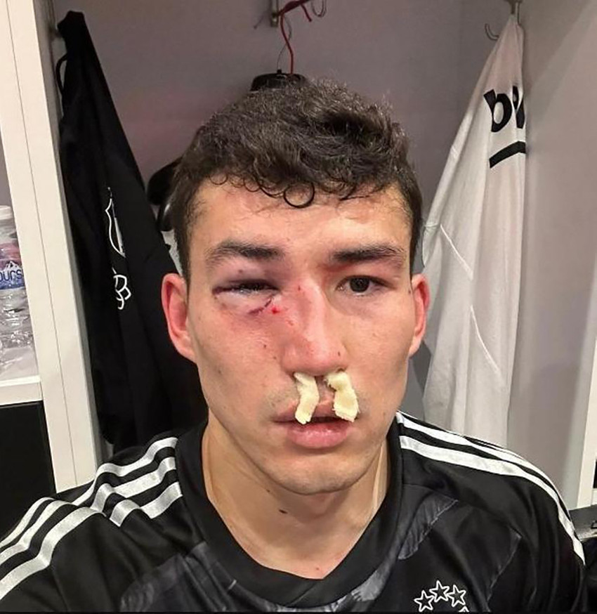 Beşiktaş'a şok! Maçta sakatlanan Bahtiyar Zaynutdinov hastaneye kaldırıldı - Resim : 1