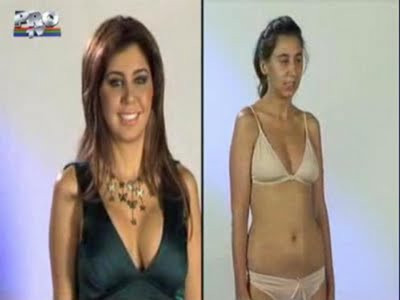 Estetik mucizesi