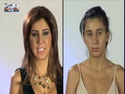 Estetik mucizesi