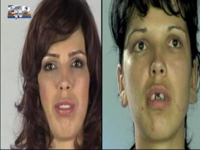 Estetik mucizesi