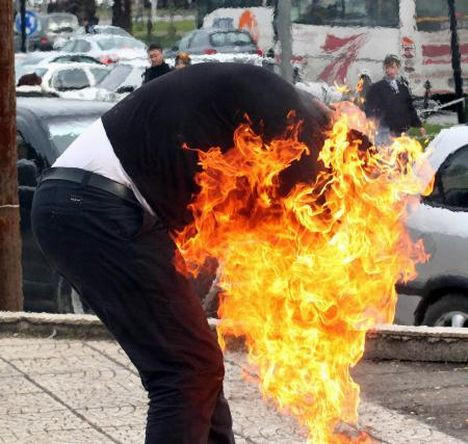 Kendini ateşe verdi !