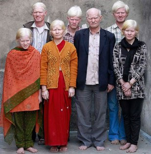 Dünyanın en büyük albino ailesi