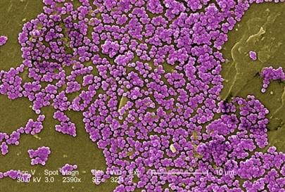 Bakterileri durduracak antibiyotik kalmayabilir