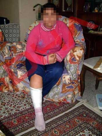 Kısa etekli kızlara kezzaplı saldırı !
