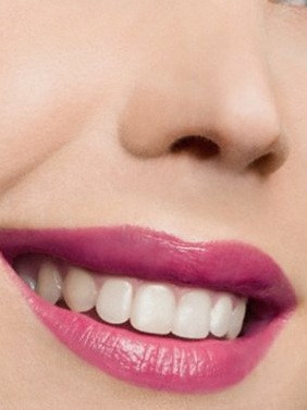 Diş sağlığı hakkında doğru bildiğimiz 30 yanlış