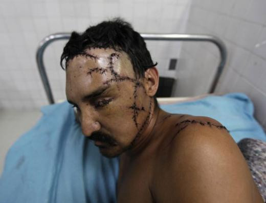 Dünyanın en şiddet dolu şehri San Pedro Sula, Honduras