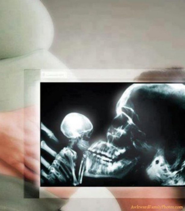 Doğumda fotoğraf çekilir mi?