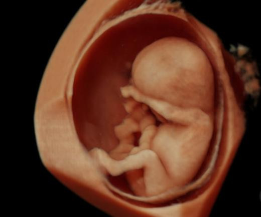 Ultrasonda çığır açtılar; 4 boyutlu mucize