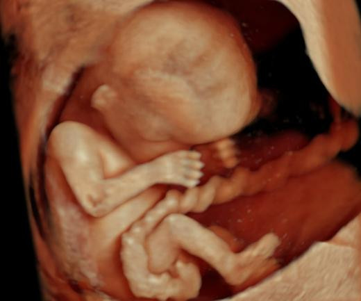Ultrasonda çığır açtılar; 4 boyutlu mucize
