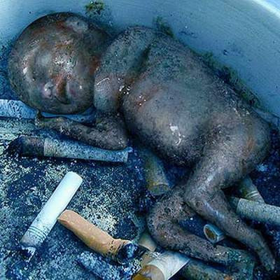 Bu fotoğraflara bakıp hala sigara içebilecek misiniz?