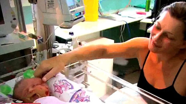 İki yüzlü bebek