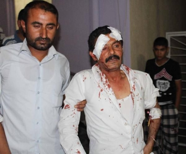 Belediye Başkanının aracının geçişi sırasında patlama