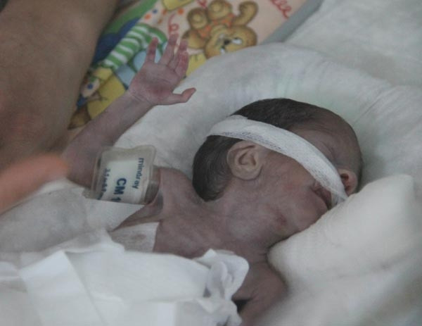 Tam anlamıyla parmak bebek