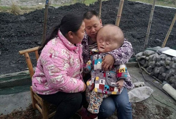 Kafası gitgide büyüyor