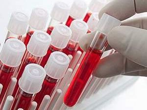 Hangi kan grubu daha şanslı?