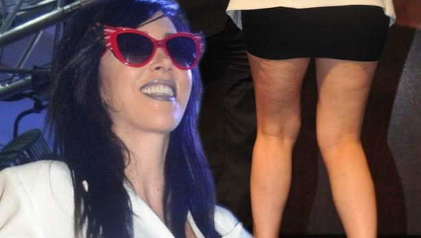 Hande Yener'den selülit açıklaması