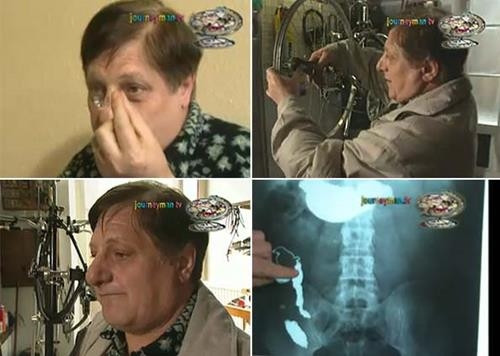 Ne bulursa yiyen adam Michel Lotito'nun tuhaf hikayesi