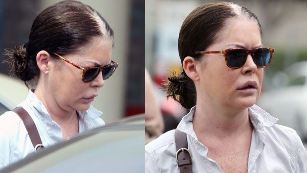 Lara Flynn Boyle'un yüzü tanınmaz hale geldi