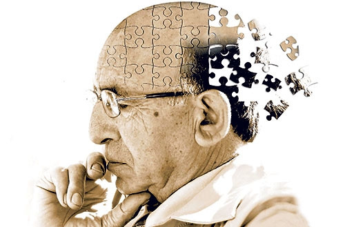 Alzheimer'ın 10 belirtisi ve tedavi yöntemleri