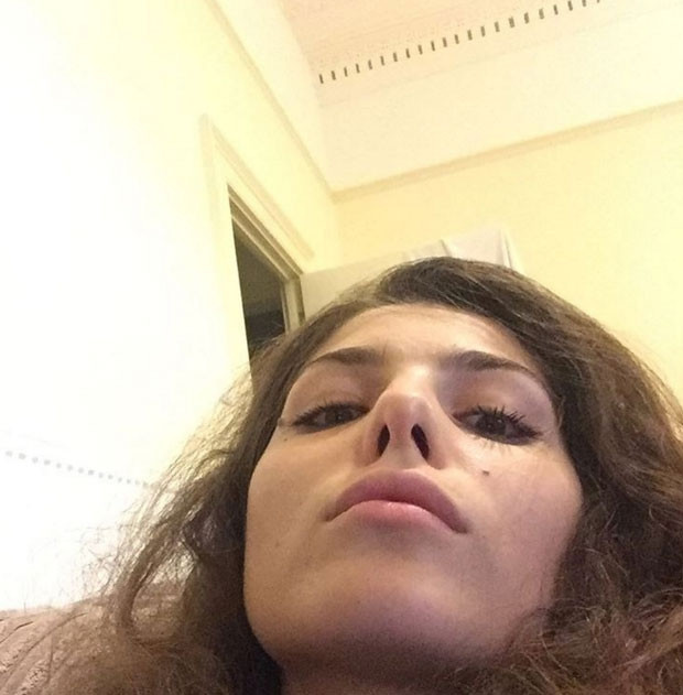 Güzel model deney kurbanı