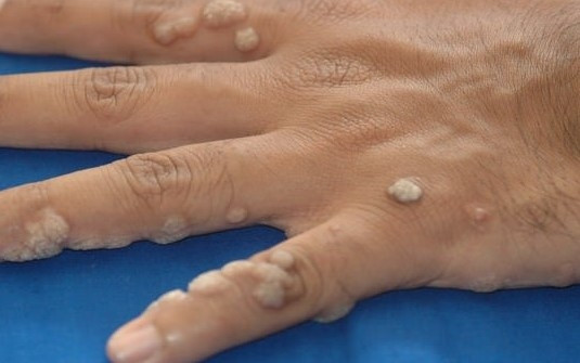 Sormaya utanılan soruların bilimsel cevapları