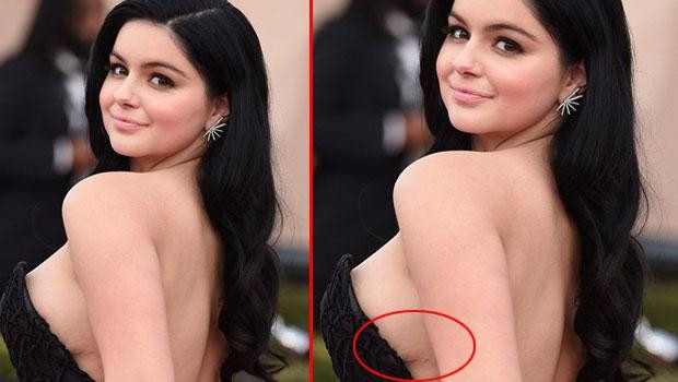 Ariel Winter ameliyat izlerine aldırmadı
