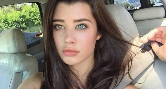 Hastalığı Instagram'ın son favorisi yaptı