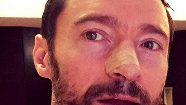 Hugh Jackman'dan kötü haber