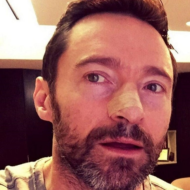 Hugh Jackman'dan kötü haber
