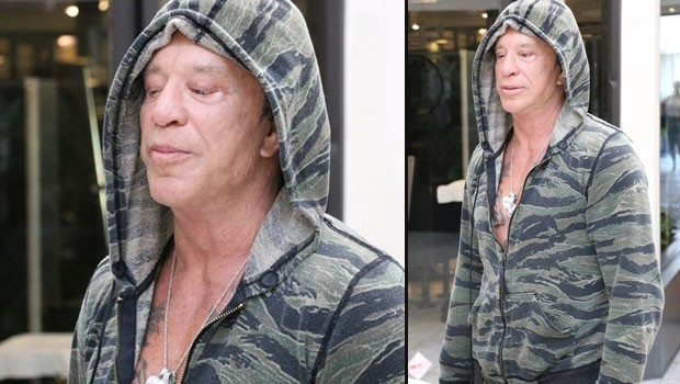 Mickey Rourke tanınmaz halde !
