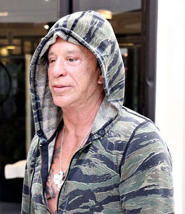 Mickey Rourke tanınmaz halde !