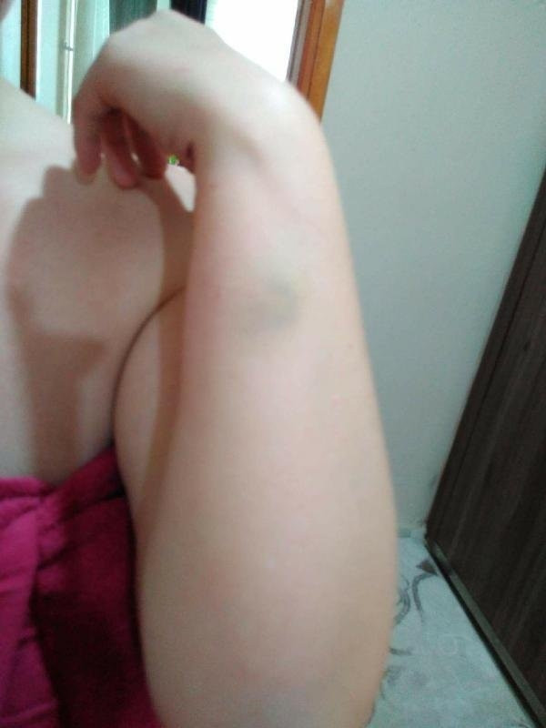 Eşinden dayak yiyen kadın fotoğrafını paylaşıp canına kıydı
