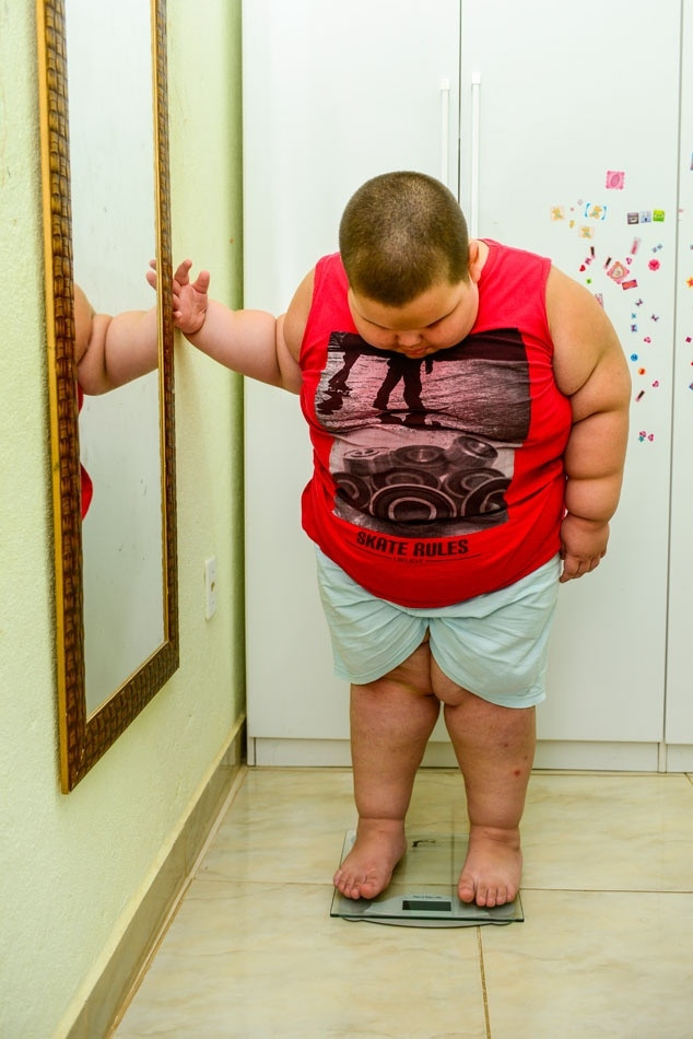 5 yaşında 80 kilo
