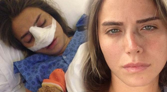 Ceyda Ateş'in burnu kırıldı