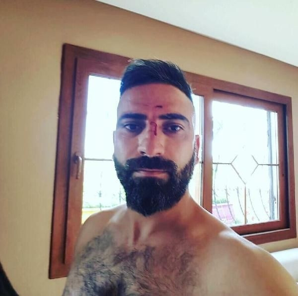 Yol verme kavgasında 8 kişiyi hastanelik etti