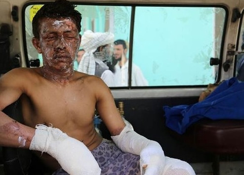 Afganistan'da korkunç kaza: 52 ölü, 73 yaralı