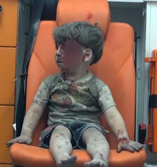 Halepli çocuk insanlığı utandırdı