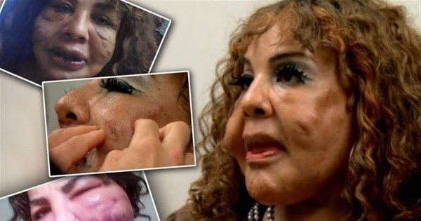 Estetik faciaları