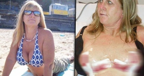 Estetik faciaları