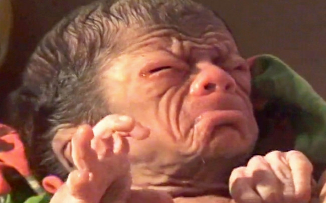 Gerçek Benjamin Button doğdu