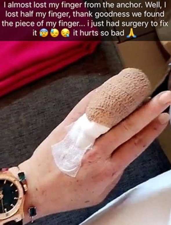 Lindsay Lohan'ın parmağı koptu !
