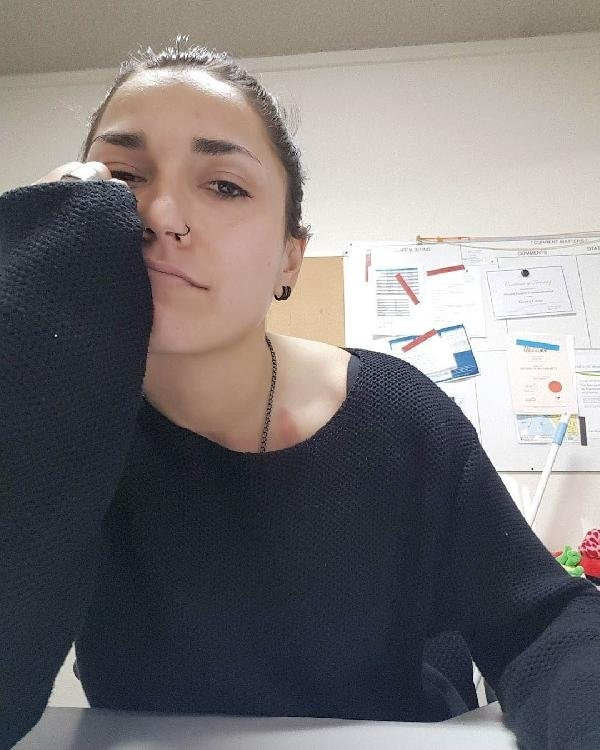 Berrak'ın kalbi dayanamadı
