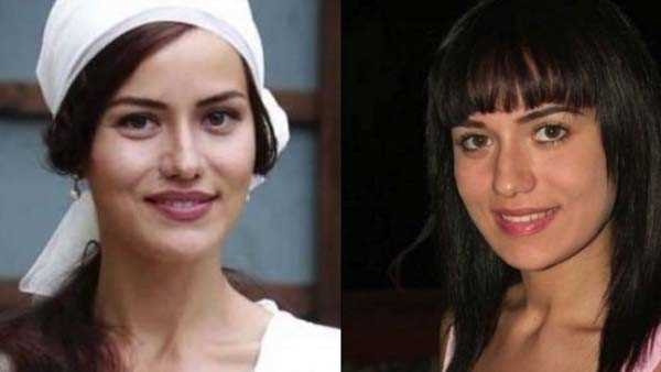 Fahriye Evcen estetik yaptırdı mı?