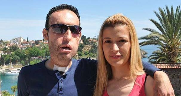 İşte yüz nakilli Recep Sert'in önceki hali