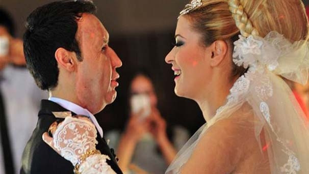 İşte yüz nakilli Recep Sert'in önceki hali