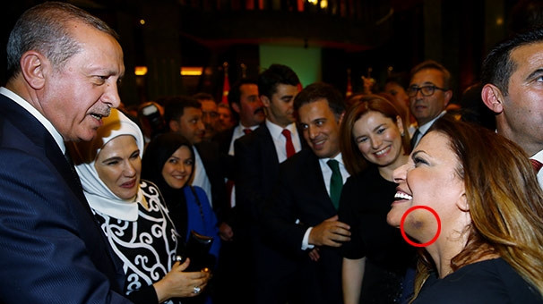 Kibariye'nin yüzüne ne oldu?