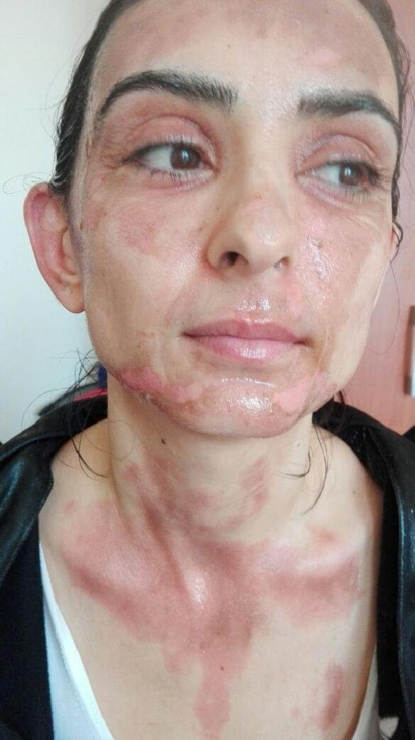 Düdüklü tencere bomba gibi patladı