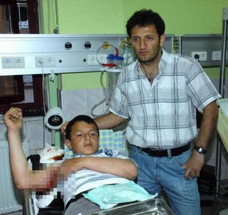 Demir parmaklık koluna saplandı