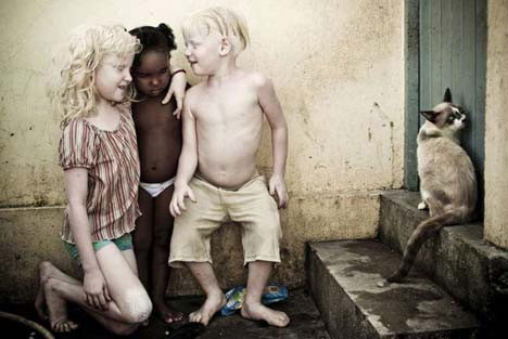 Dünyayı şaşırtan albino kardeşler