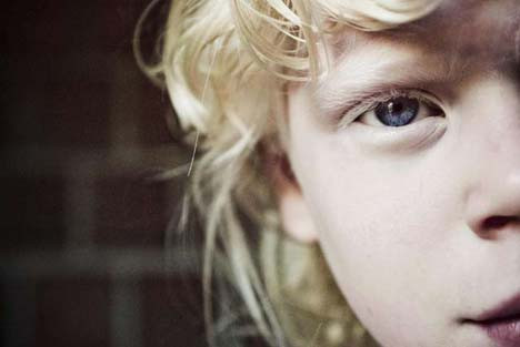 Dünyayı şaşırtan albino kardeşler